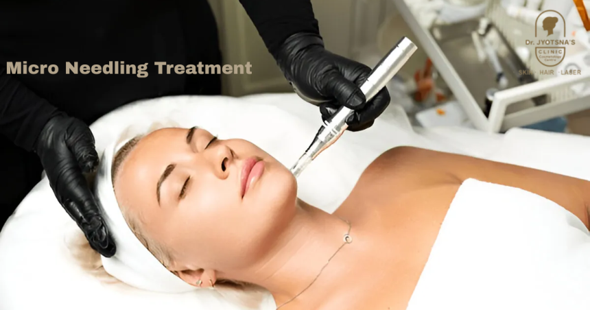 Fresh Skin, Naturally: Micro Needling Treatment in Thane