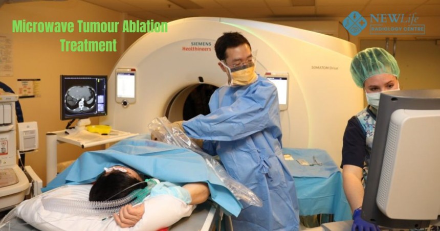 Microwave Tumour Ablation Treatment in Thane – A Smart Approach to Targeted Tumour Care