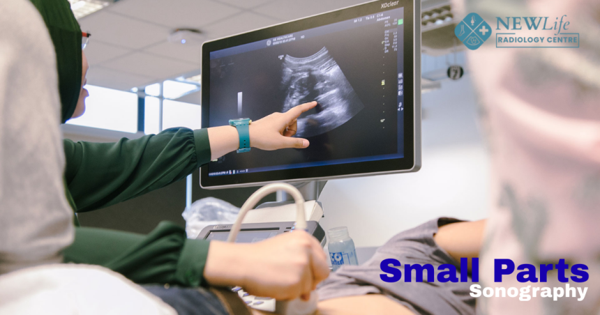 Small Parts Sonography Treatment in Thane – Precision Imaging at New Life Radiology Centre