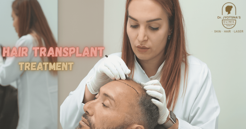 Hair Transplant Treatment
