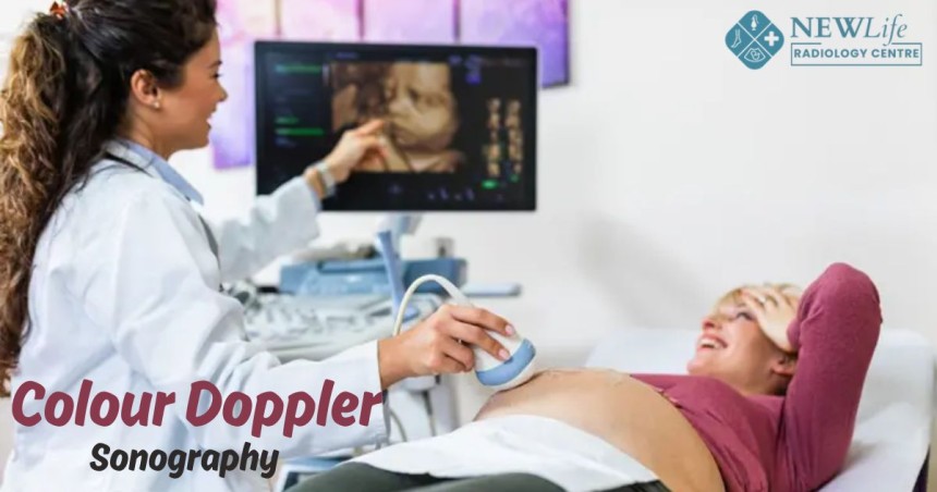 Colour Doppler Sonography