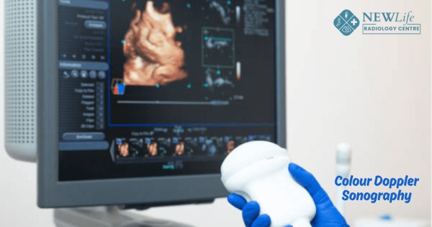 Colour Doppler Sonography