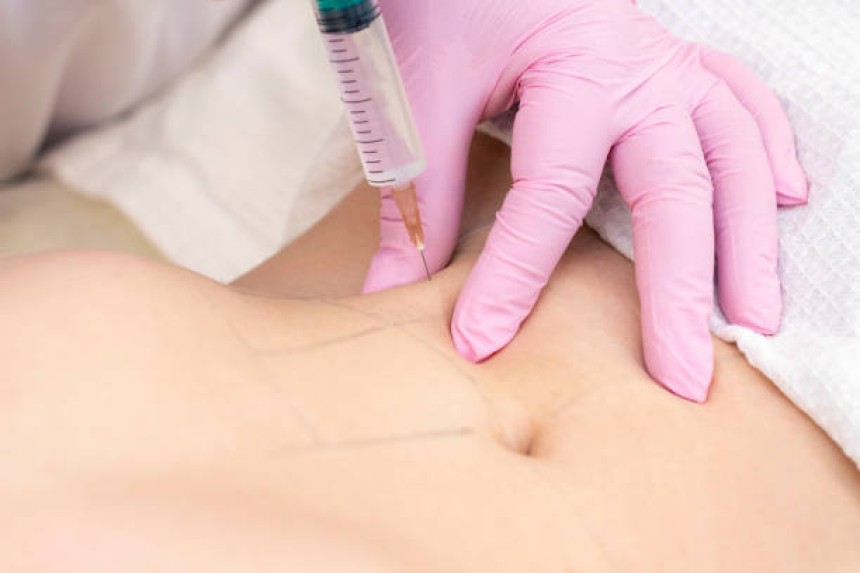 Fat Melting Injections in Riyadh